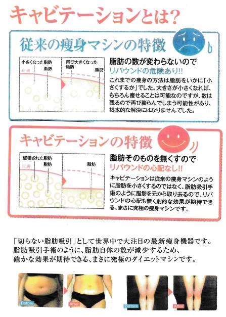 1 1